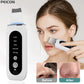 Black Dots Blackhead Remover Facial Peeling Machine