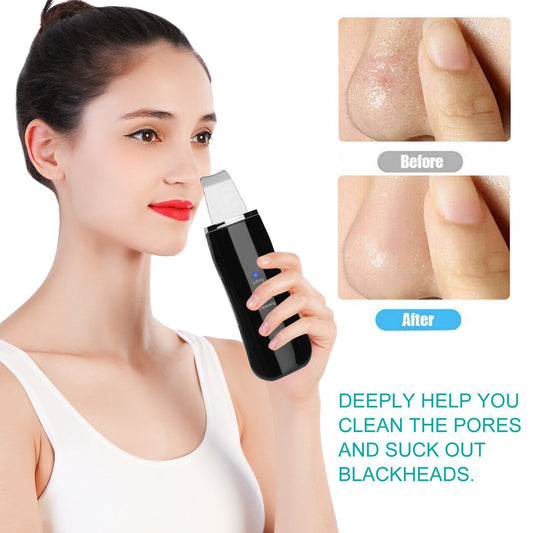 Black Dots Blackhead Remover Facial Peeling Machine
